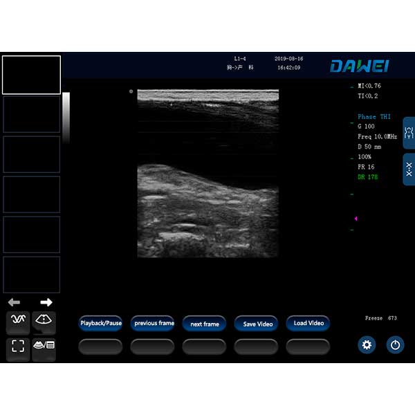 Echographie de la vessie animale