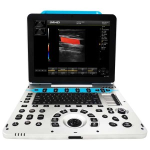 macchina ad ultrasuoni portatile