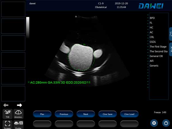 portable vet ultrasound machine