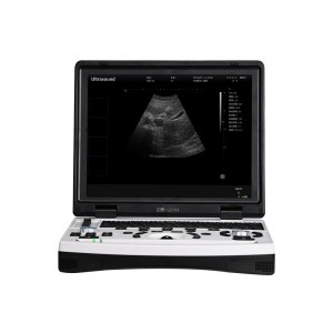 Instrumento de diagnóstico por ultrassom veterinário digital completo para laptop 690-VET