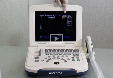 Portable Vet Ultrasound MU10