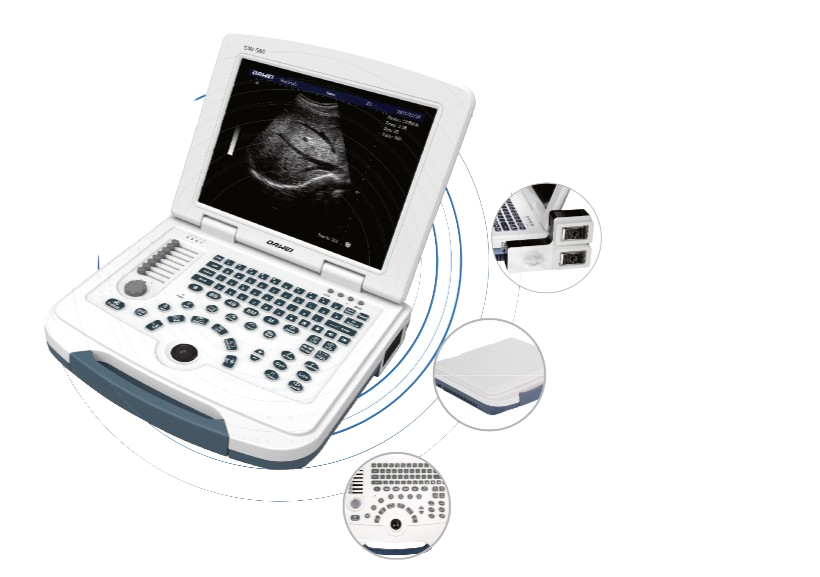 Laptop portable ultrasound machine