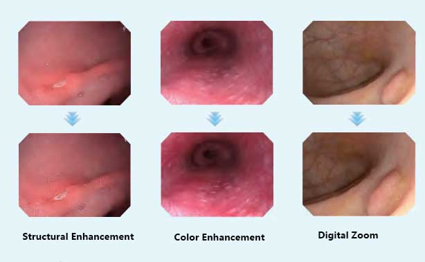 veterinary endoscopy system