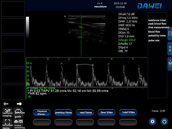 Pulse Doppler mode