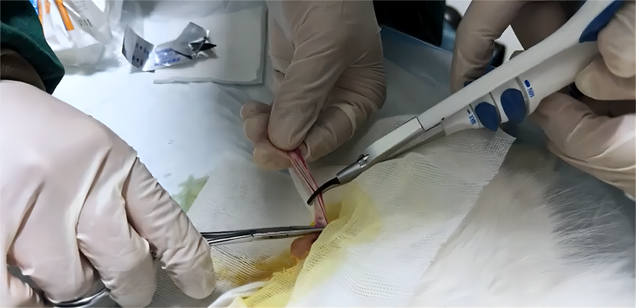 ultrasonic scalpel