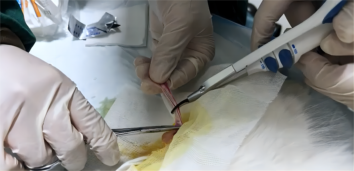 scalpel à ultrasons