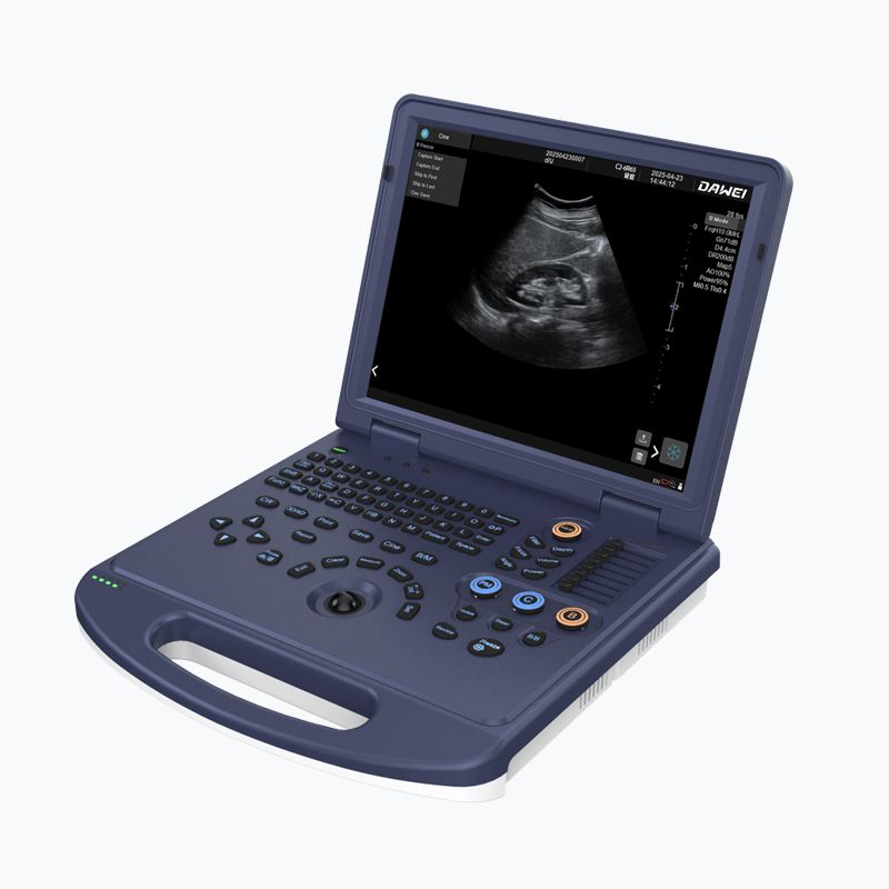 Veterinary Color Doppler Ultrasound Diagnostic System