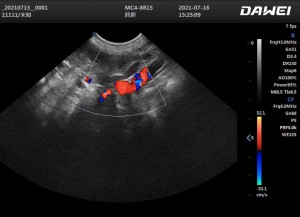 Dog’s Adrenal glands