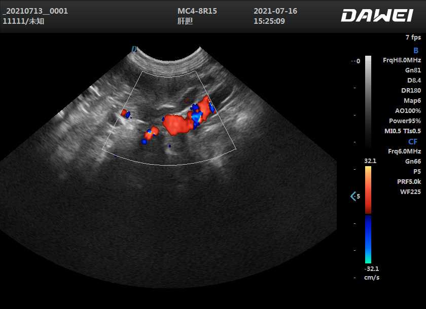 Dog’s Adrenal glands