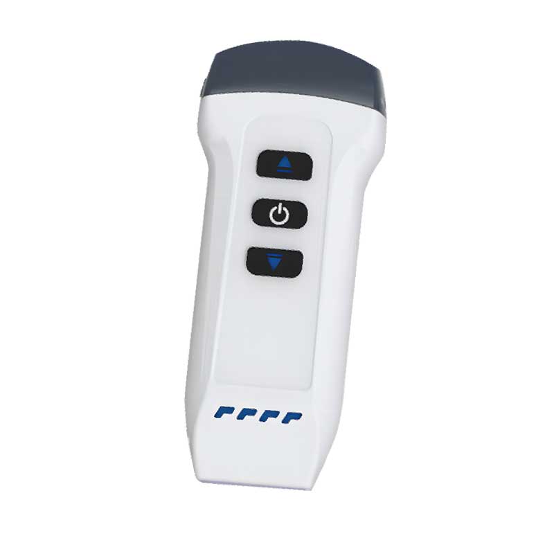 wireless ultrasound