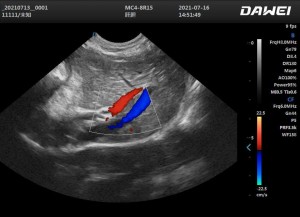 Cat’s Liver
