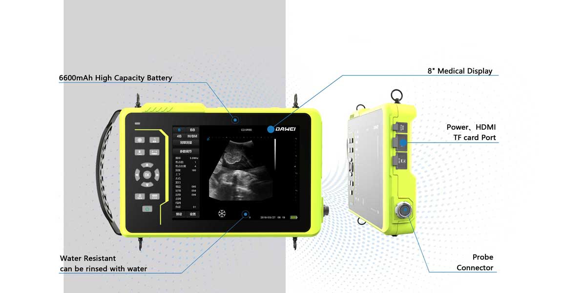 Dispositivo portátil de ultrassom