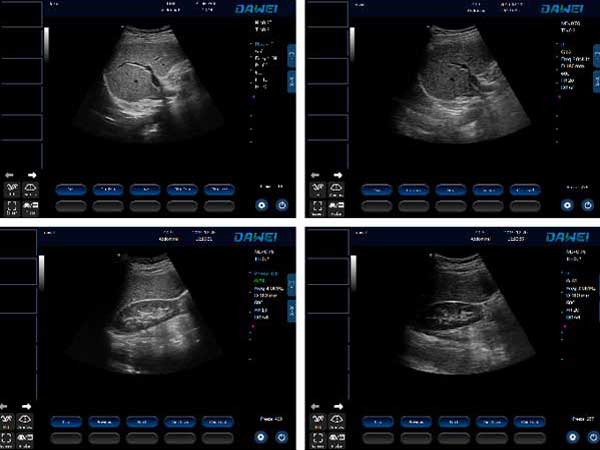 portable vet ultrasound machine