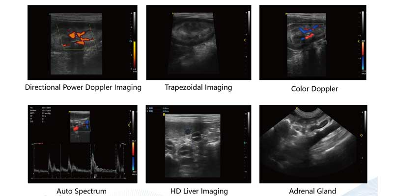 ultrasound image