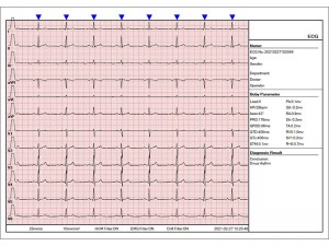 Eletrocardiogramas multiparâmetros de 12 canais