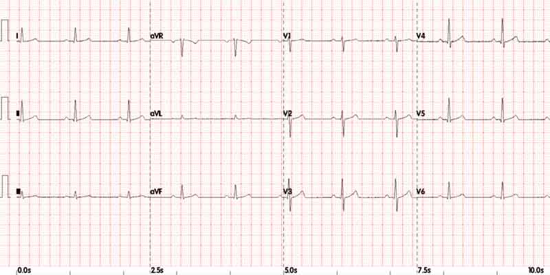 animal de estimação ECG