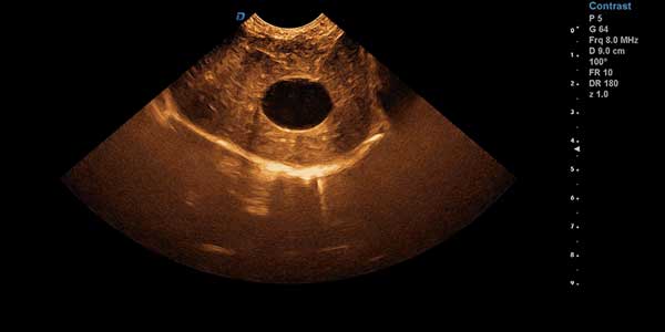 Imagens clínicas de ultrassonografias de animais