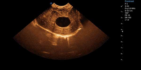 动物超声临床图像