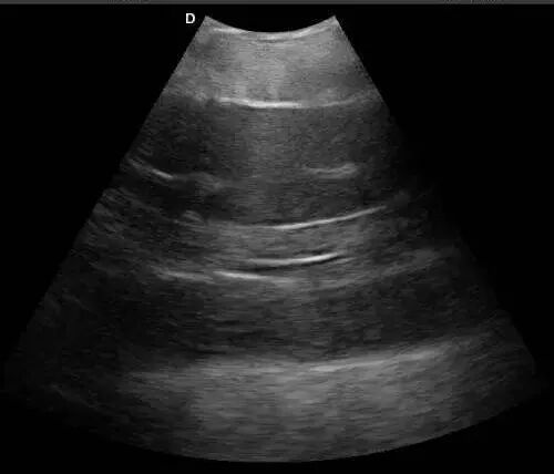 Sturgeon ultrasound
