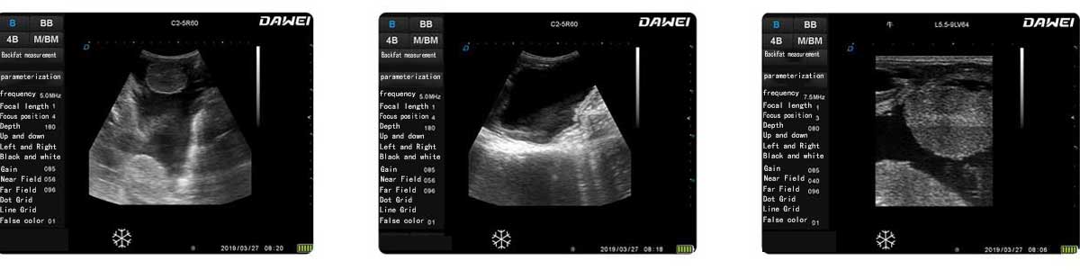 Imagens clínicas de ultrassom