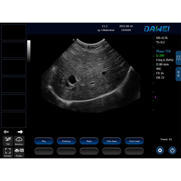 Ultrassonografia de fígado animal