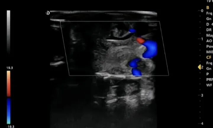 Crayfish ultrasound