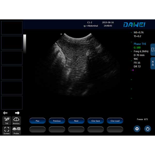 Ultrasound of the spleen in animals