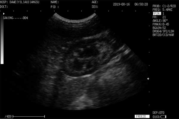 vet ultrasound