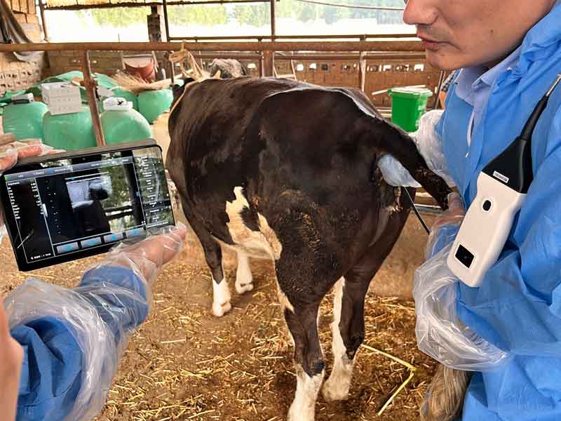 Rectal Ultrasound Probe