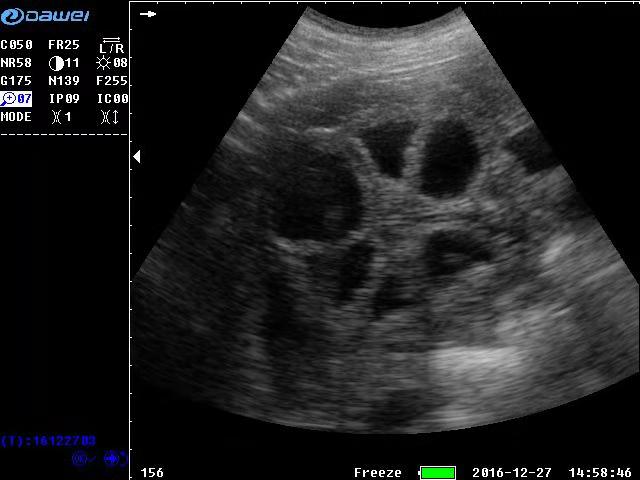 Ultrasound clinical images of sows in early conception