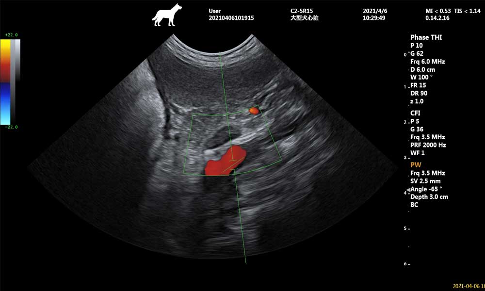 Adrenal-PW-localization