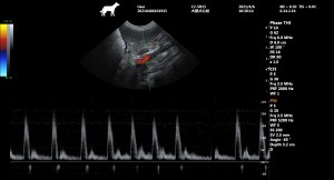 Adrenal bez PW