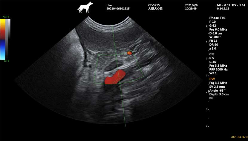 Adrenal-imaging