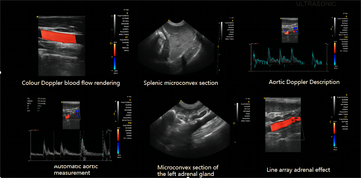 Images cliniques médicales de Dawei Pet