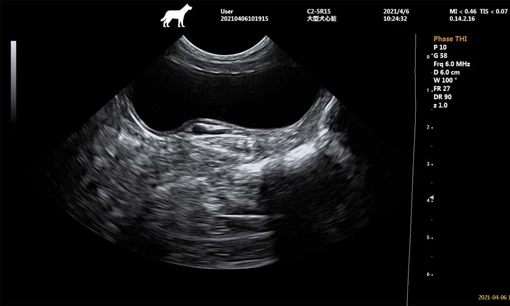 Effet de l'incision transversale de la vessie