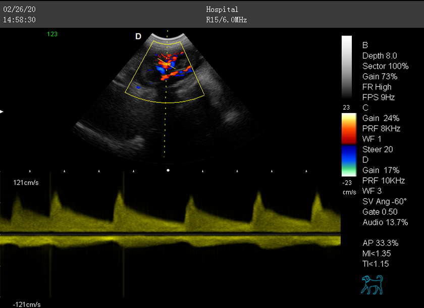 Kidney-PW-effect