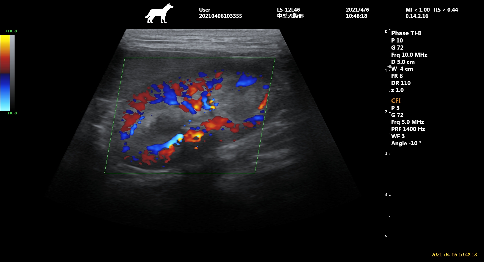 Kidney trapezoidal imaging