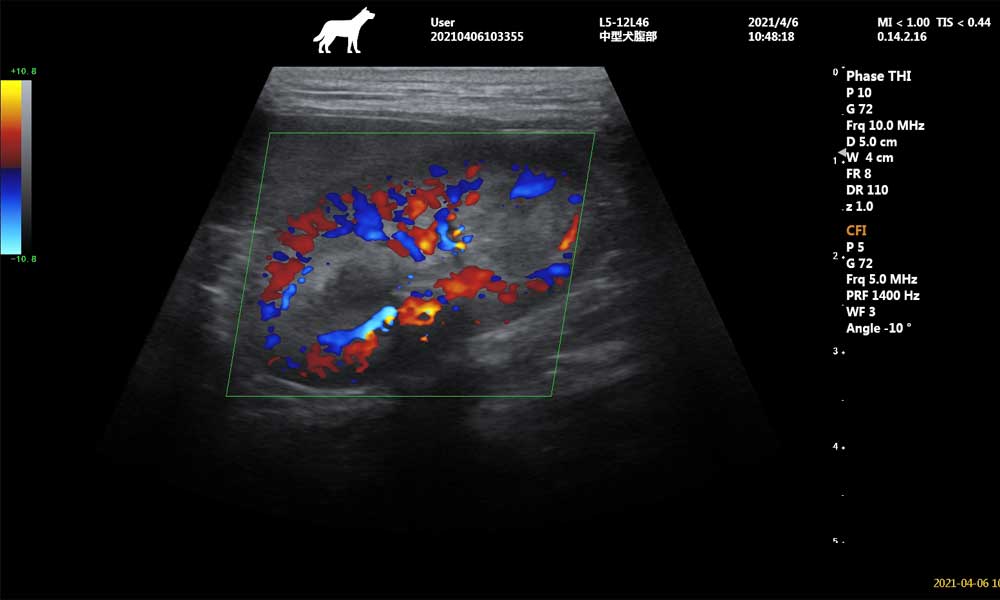 Efecto-del-flujo-sanguíneo-renal-de-imagen-trapezoidal-de-matriz-lineal