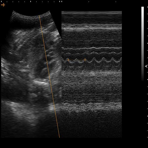 M-mode-HR-measurement.1