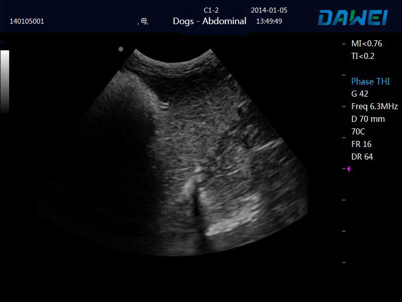 Microconvex-spleen-effect