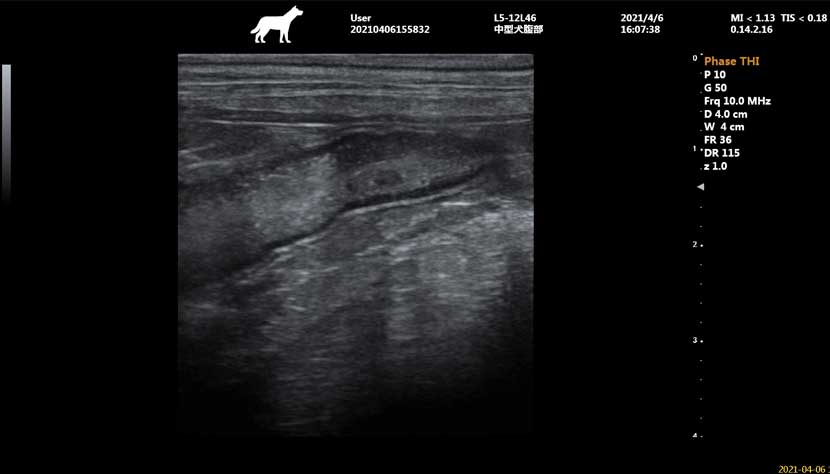 Imaging della milza con sonda lineare.