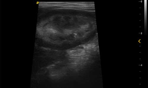 Imaging trapezoidale