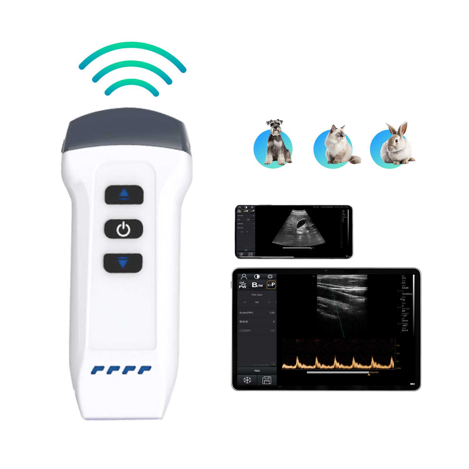 wireless ultrasound