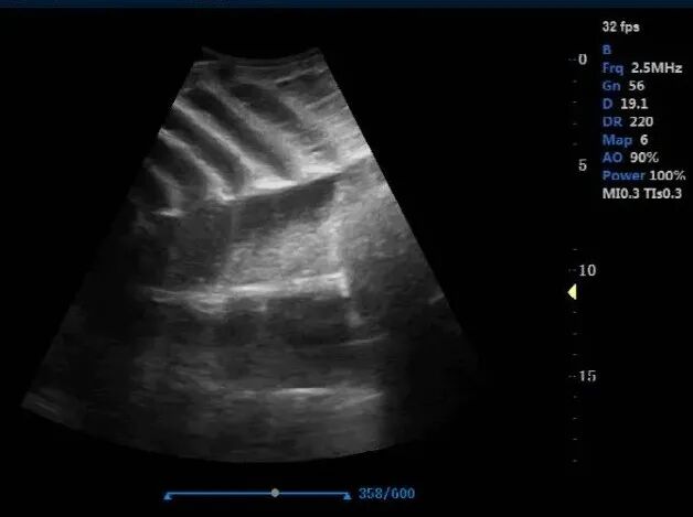 Sturgeon ultrasound