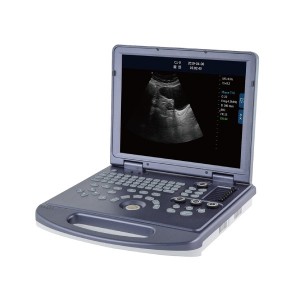 Sistema de diagnóstico de ultrasonido blanco y negro veterinario completo de Digitaces de la plataforma de la PC