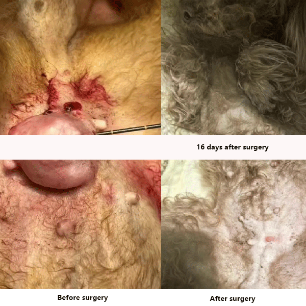 Breast tumour ablation