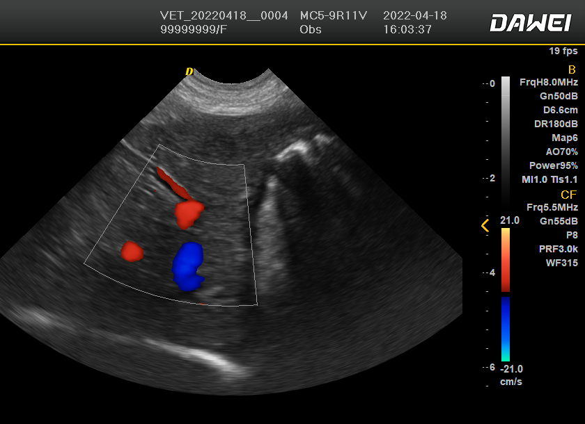 color doppler ultrasound image