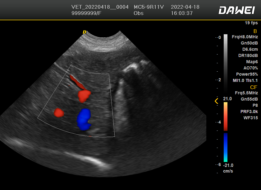 imagem de ultrassom doppler colorido