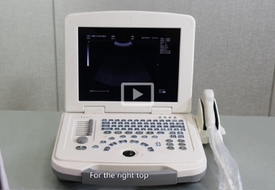 Ноутбук BW Ultrasound MU12