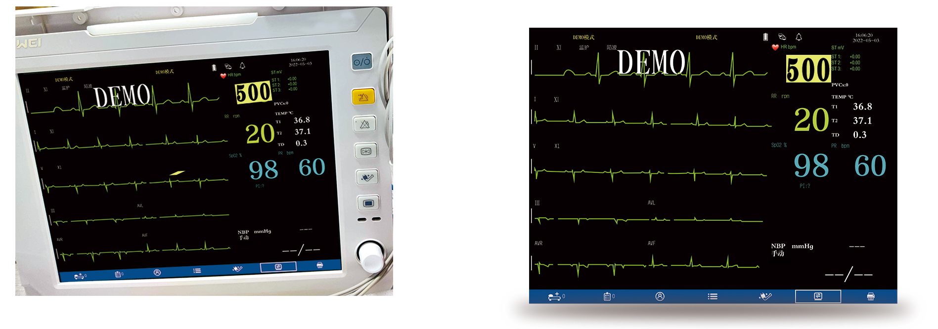 Détection de la fréquence cardiaque